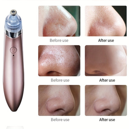 Face Pore Cleaner, Electric Blackhead Removal Beauty Instrument Vacuum Suction Face Pores Cleaning Device for Face Skin Deep Cleansing